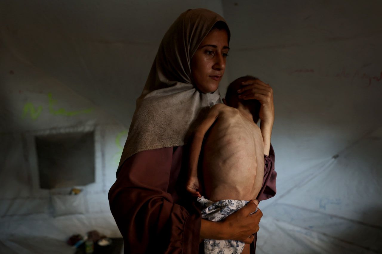 نەتەوەیەکگرتووەکان: لە غەززە زیاتر لە 100 منداڵ لە برسان مردوون